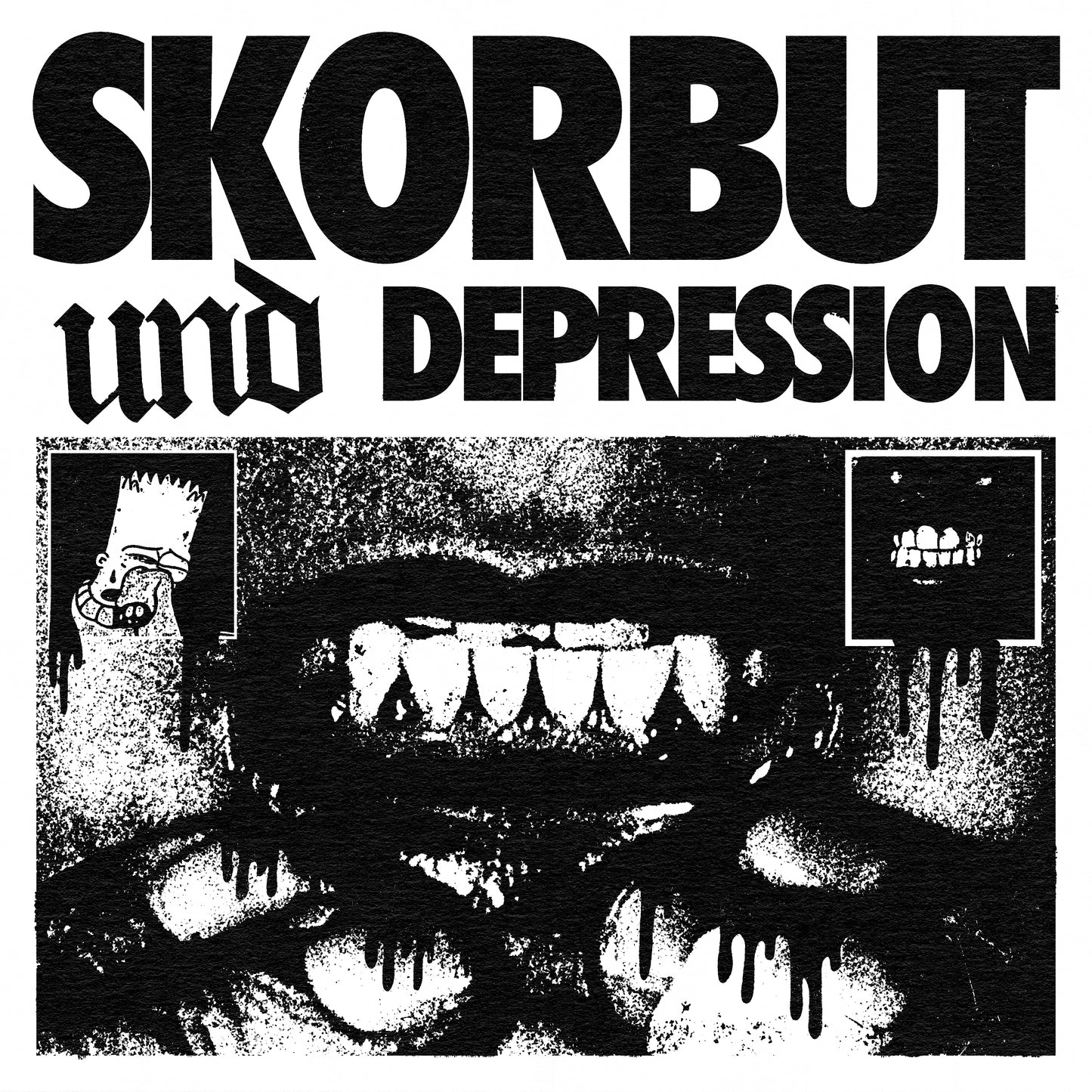 Skorbut und Depression